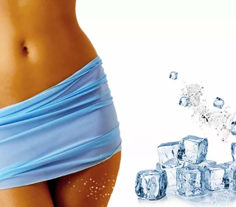 Cryolipolyse 360° Nice